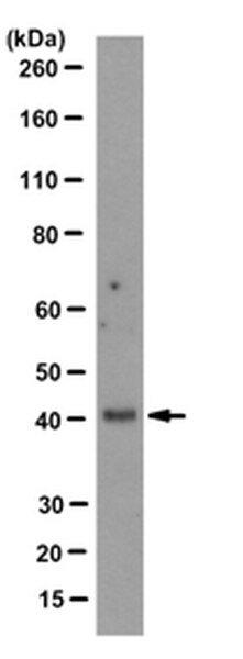 Anti-Epithelial Specific Antigen Antibody, clone VU-1D9 | CBL251